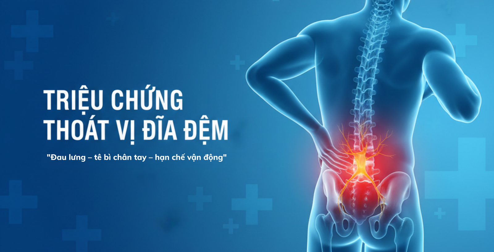 Triệu Chứng Thoát Vị Đĩa Đệm – Dấu Hiệu Sớm Không Nên Bỏ Qua